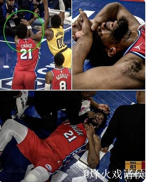 恩比德鼻子骨折76人不敌步行者 骑士力克奇才 恩比德鼻子骨折76人不敌步行者 骑士力克奇才